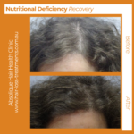 Food for hair growth and thickness