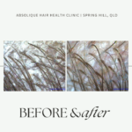Scalp Treatment - Itchy Scalp Relief