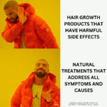 Hair Regrowth Without Side Effects - No Minoxidil