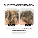 Natural Hair Loss Treatments for Men