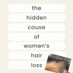 Hair Loss in Women – Hair Health