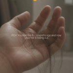 Hair Loss From High Fever in Teenage Male